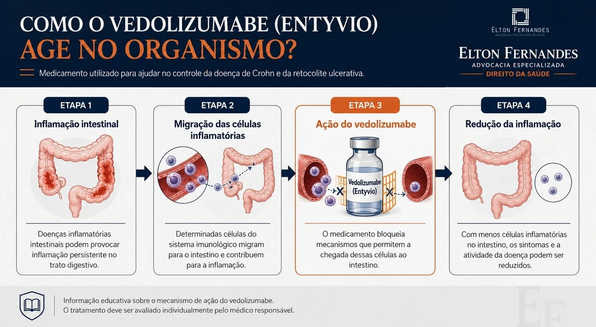 Infográfico mostrando como o vedolizumabe atua no controle da inflamação intestinal.
