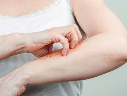 Guselcumabe - Tremfya: Plano de saúde deve fornecer remédio 