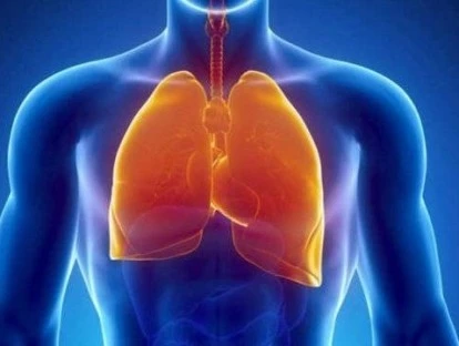 Erro de Diagnóstico - Tuberculose