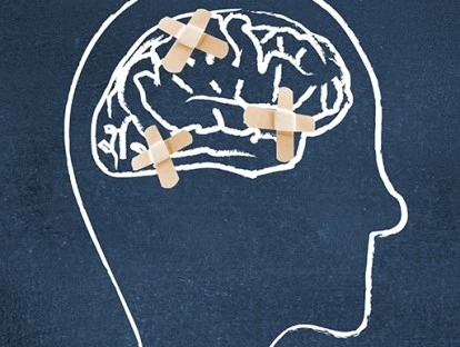 Prótese e cirurgia para tratar epilepsia pelo plano de saúde