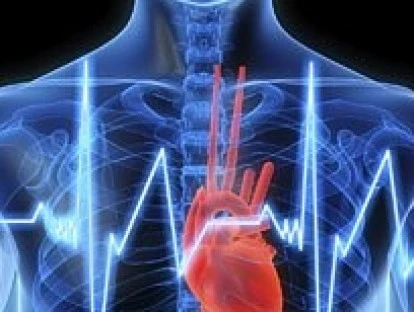 Implantação de prótese valvar TAVI por via percutânea