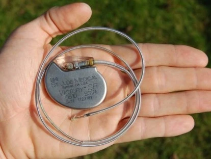 Marcapasso deve ser fornecido pelo convênio médico