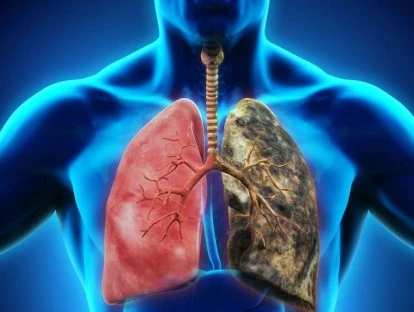 Tagrisso - Osimertibe