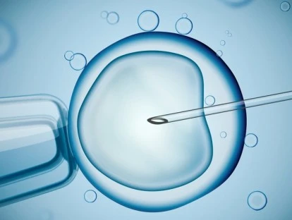 Fertilização in vitro