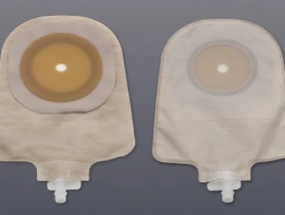 Plano de saúde deve custear bolsa de urostomia e acessórios