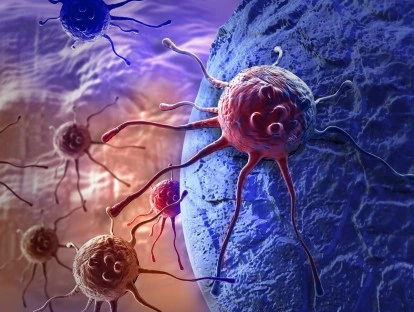 Plano de saúde autogestão deve pagar cirurgia robótica por HIFU