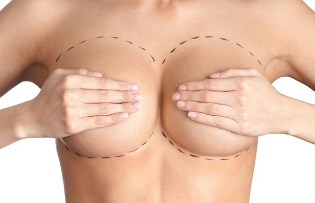 Reconstrução mamária com prótese: plano de saúde deve custear? Entenda