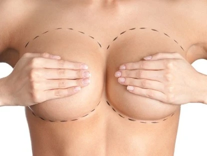 Reconstrução mamária com prótese: plano de saúde deve custear? Entenda