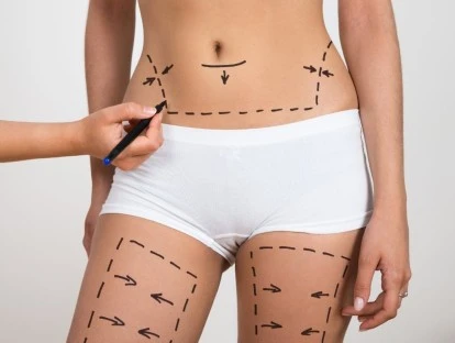 Plano de saúde deve pagar cirurgia de retirada de pele