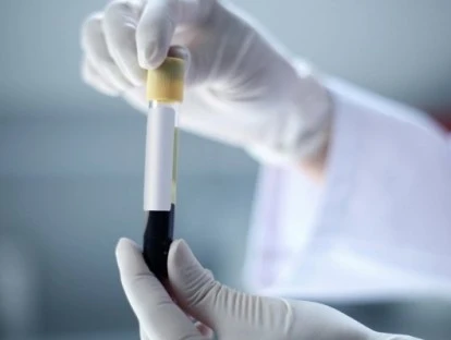 Detecção de zika vírus