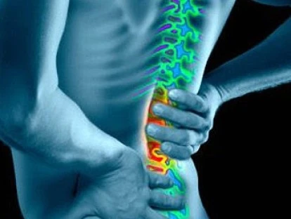 Radiculotomia lombar e tratamento cirúrgico para hérnia discal.