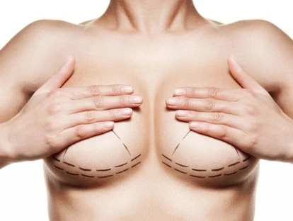 Gigantomastia (redução de mamas): plano de saúde deve custear procedimento