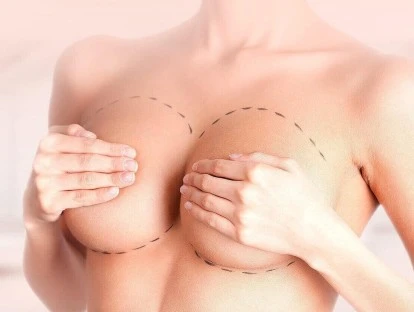 Prótese mamária pós-bariátrica deve ser coberta pelo plano de saúde