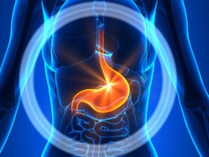 Stelara - Ustequinumabe - Paciente com doença de Chron consegue medicamento na Justiça