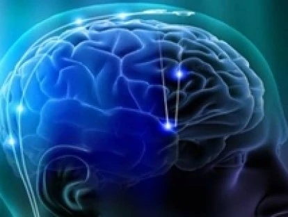 Estimulação magnética transcraniana