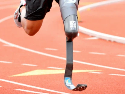 Plano de saúde deve pagar prótese mesmo que contrato seja antigo e anterior a 1998