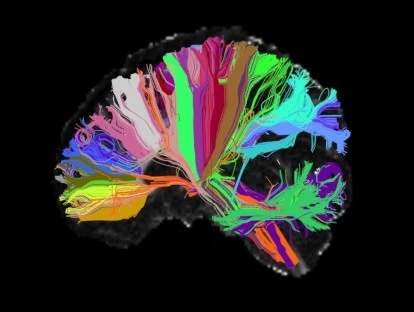Plano de saúde é condenado a custear neuronavegador