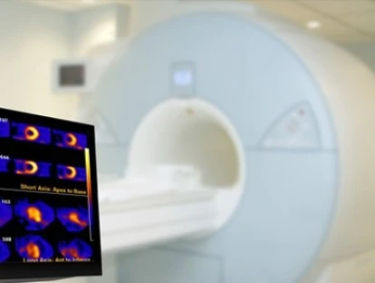 Cintilografia miocárdica: plano de saúde é condenado pela Justiça a custear exame