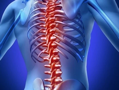 Cirurgia para tratamento de artodrose de coluna