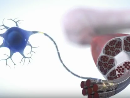 Spinraza (nusinersena) pelo plano de saúde: entenda!