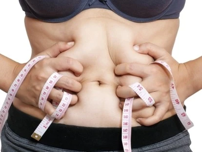 Plano de saúde deve custear cirurgia plástica pós-bariátrica 