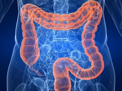 Colectomia por videolaparoscopia