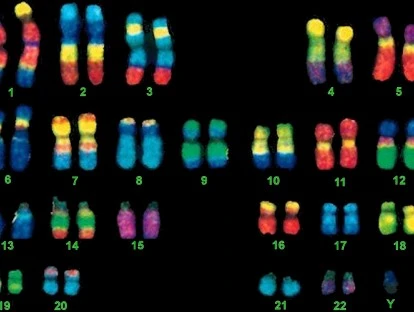 Plano de saúde é condenado a pagar teste de CGH Array
