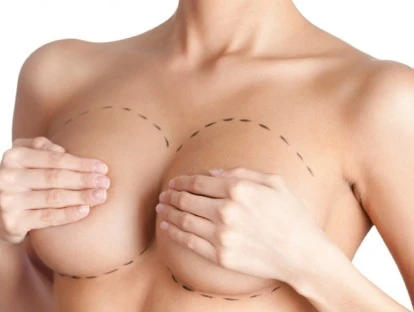 Plano de saúde deve custear mamoplastia redutora