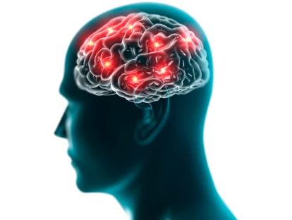 Estimulação Magnética Transcraniana Profunda