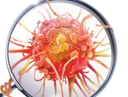 Plano de saúde deve pagar radioterapia IMRT 