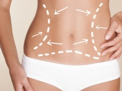 Mamoplastia e abdominoplastia 