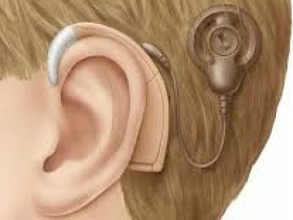 Criança consegue troca do processador do implante coclear