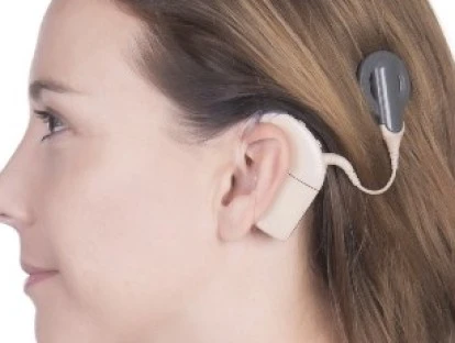 Implante coclear: plano de saúde deve fornecer aparelho mais moderno