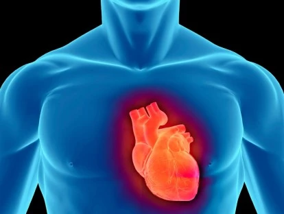 Plano de saúde deve autorizar cirurgia de revascularização miocárdica