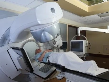 Radioterapia por intensidade modulada por feixe cônico - IMRT.