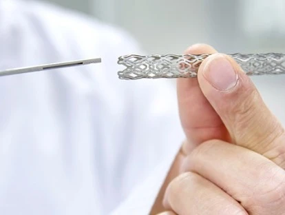  Angioplastia coronariana com colocação de stents pelo plano de saúde