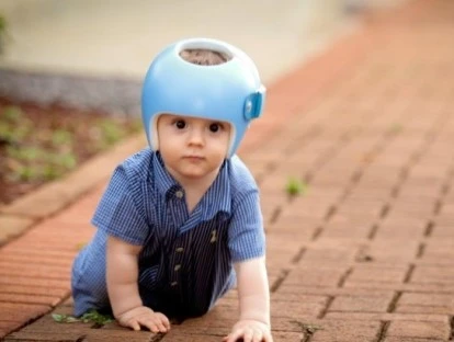 Capacete para tratar plagiocefalia posicional