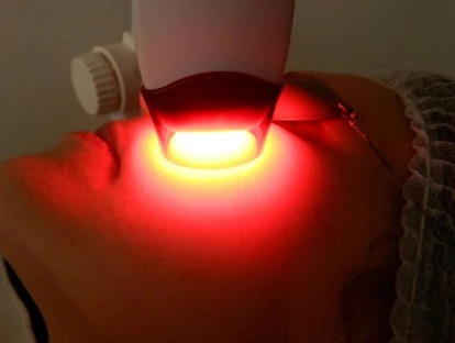 Terapia fotodinâmica (PDT) pelo plano de saúde: saiba como!