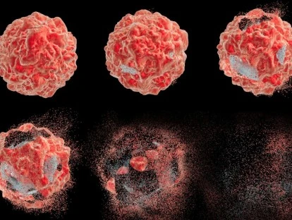 Plano de saúde deve custear Radioterapia Hipofracionada