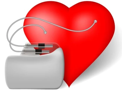 Plano de saúde deve cobrir marca-passo para paciente mesmo se o contrato for antigo