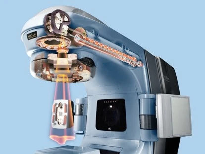 Justiça manda plano de saúde autorizar  Radioterapia com Intensidade Modulada