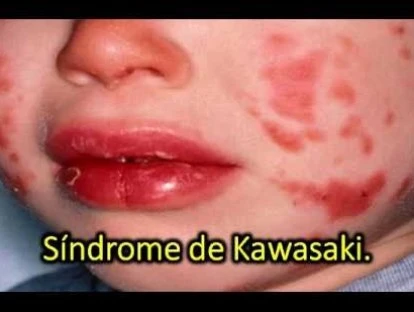 Carência no plano de saúde