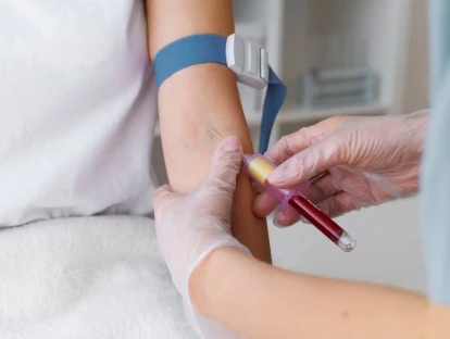 Exame AdamTS 13 deve ser custeado pelo plano de saúde