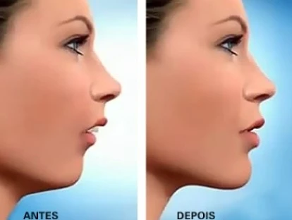 Cirurgia de buco-maxilo-facial