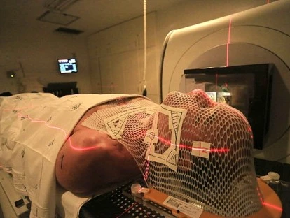 Radioterapia estereotáxica: mesmo fora do rol da ANS, plano de saúde deve custear