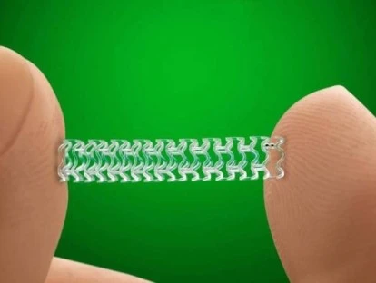 Stent biorreabsorvível - Confira quando o plano de saúde deve cobrir