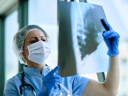 Pirfenidona pelo plano de saúde: como obter medicamento para fibrose pulmonar idiopática