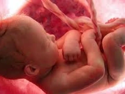 Cirurgia de derivação ventrículo-amniótica pelo plano de saúde: como obter custeio?