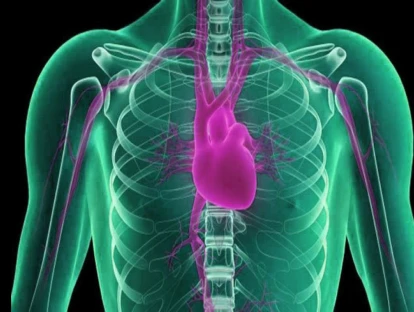 Plano de saúde deve custear angiotomografia coronariana