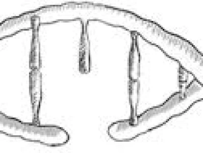 Lynparza - Olaparibe